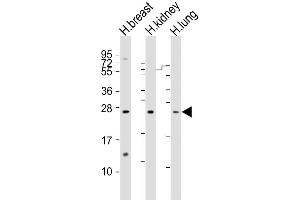 Western Blot at 1:1000-1:2000 dilution Lane 1: human breast lysate Lane 2: human kidney lysate Lane 3: human lung lysate Lysates/proteins at 20 ug per lane. (Adrenomedullin antibody  (AA 69-96))
