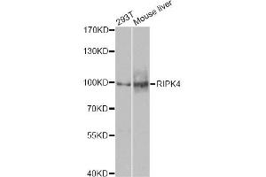 Western blot analysis of extracts of various cell lines, using RIPK4 antibody.