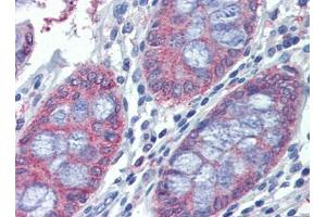 Human Colon: Formalin-Fixed, Paraffin-Embedded (FFPE) (METTL7B antibody  (C-Term))