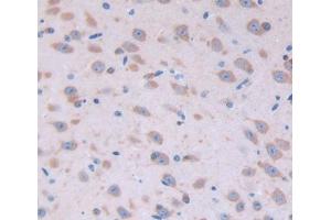 Used in DAB staining on fromalin fixed paraffin- embedded Kidney tissue (FGF22 antibody  (AA 26-162))