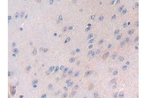 Detection of LTBP1 in Mouse Cerebrum Tissue using Polyclonal Antibody to Latent Transforming Growth Factor Beta Binding Protein 1 (LTBP1) (LTBP1 antibody  (AA 1415-1712))