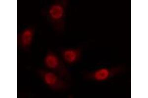 ABIN6274263 staining 293 cells by IF/ICC. (CDK8 antibody  (N-Term))
