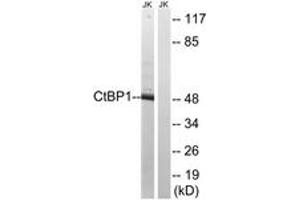Western blot analysis of extracts from Jurkat cells, using CtBP1 (Ab-422) Antibody.