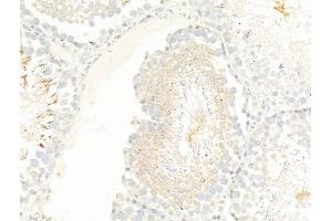 ABIN7094884 and ABIN7098937 at 1/100 staining Rat testis tissue by IHC-P.