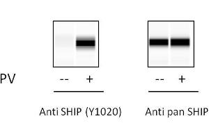 THP1 cells were treated with Pervanadate. (INPP5D ELISA Kit)