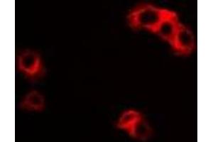 Immunofluorescent analysis of IL-23R staining in HepG2 cells. (IL23R antibody)