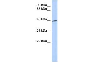 WB Suggested Anti-TRIB1 Antibody Titration: 0. (TRIB1 antibody  (Middle Region))