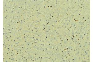 ABIN6277579 at 1/100 staining Mouse brain tissue by IHC-P. (STXBP1 antibody  (C-Term))