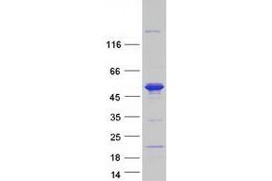 Western Blotting (WB) image for Sorting Nexin 15 (SNX15) (Transcript Variant A) protein (Myc-DYKDDDDK Tag) (ABIN2732393)