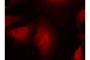 Immunofluorescence staining of methanol-fixed HeLa cells using MDM2 polyclonal antibody (Cat # PAB12253, Red). (MDM2 antibody  (Ser166))