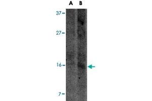 Western blot analysis of UCMA in SW1353 cell lysate with UCMA polyclonal antibody  at (A) 2.