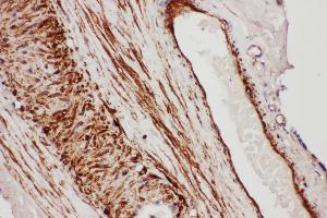 Anti- TFPI antibody, IHC(P) IHC(P): Human Placenta Tissue (TFPI antibody  (N-Term))