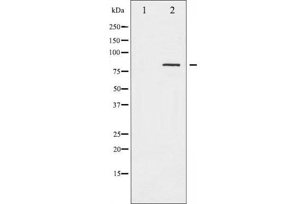 Caldesmon 抗体  (pSer789)