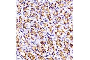 Immunohistochemistry (Paraffin-embedded Sections) (IHC (p)) image for anti-Linker For Activation of T Cells Family, Member 2 (LAT2) antibody (ABIN7074503)