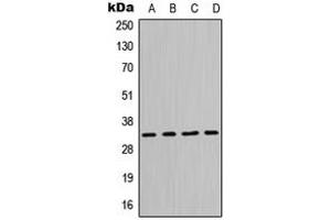 Western blot analysis of MPG expression in Jurkat (A), HeLa (B), Raw264. (MPG antibody  (N-Term))