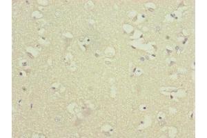 Immunohistochemistry of paraffin-embedded human brain tissue using ABIN7144847 at dilution of 1:100 (ATP5F1D antibody  (AA 1-168))