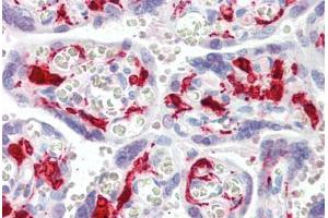 Human Placenta (formalin-fixed, paraffin-embedded) stained with F13A1 antibody ABIN461969 at 5 ug/ml followed by biotinylated secondary antibody, alkaline phosphatase-streptavidin and chromogen. (F13A1 antibody)
