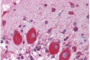 Human Brain, Cerebellum (formalin-fixed, paraffin-embedded) stained with NUCB1 antibody ABIN214130 at 5 ug/ml followed by biotinylated goat anti-rabbit IgG secondary antibody ABIN481713, alkaline phosphatase-streptavidin and chromogen. (Nucleobindin 1 antibody  (C-Term))