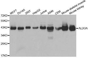 Western blot analysis of extracts of various cell lines, using ALDOA antibody. (ALDOA antibody  (AA 1-348))