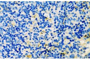 Immunohistochemistry of paraffin-embedded Mouse spleen using TIM-3/HAVCR2 Polyclonal Antibody at dilution of 1:200 (40x lens). (TIM3 antibody)