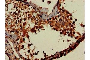 Immunohistochemistry of paraffin-embedded human testis tissue using ABIN7155530 at dilution of 1:100 (DOT1L antibody  (AA 331-484))