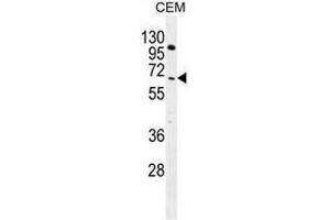 COL8A2 Antibody (C-term) western blot analysis in CEM cell line lysates (35µg/lane). (COL8a2 antibody  (C-Term, Chain alpha 2))