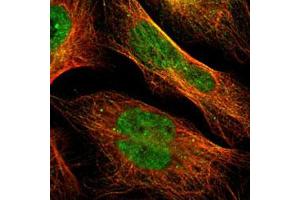 Immunofluorescent staining of U-2 OS with MAPK3 polyclonal antibody  (Green) shows positivity in microtubules and nucleus but excluded from the nucleoli. (ERK1 antibody)