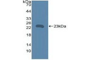 Detection of Recombinant TNFRSF5, Human using Polyclonal Antibody to Tumor Necrosis Factor Receptor Superfamily, Member 5 (CD40) (CD40 antibody  (AA 26-187))