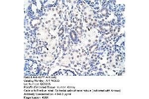 Rabbit Anti-NIP7 Antibody  Paraffin Embedded Tissue: Human Kidney Cellular Data: Epithelial cells of renal tubule Antibody Concentration: 4. (NIP7 antibody  (C-Term))