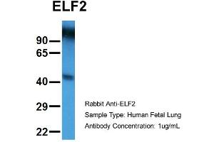 Host:  Rabbit  Target Name:  ELF2  Sample Type:  Human Fetal Lung  Antibody Dilution:  1. (ELF2 antibody  (N-Term))