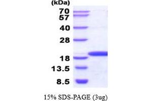 SDS-PAGE (SDS) image for NME/NM23 Nucleoside Diphosphate Kinase 3 (NME3) (AA 22-169) (Active) protein (His tag) (ABIN5854461)