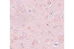 Immunohistochemistry (IHC) image for anti-Synaptogyrin 2 (SYNGR2) (N-Term) antibody (ABIN1031591) (SYNGR2 antibody  (N-Term))