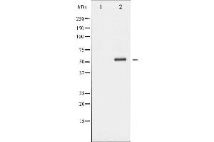 Western Blotting (WB) image for anti-Checkpoint Kinase 2 (CHEK2) (pThr68) antibody (ABIN6256592)