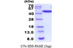 SDS-PAGE (SDS) image for Phosphoglycerate Kinase 1 (PGK1) (AA 1-417) (Active) protein (His tag) (ABIN6387707)
