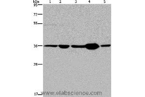 Western blot analysis of Human transitional cell carcinoma tissue, 293T and A172 cell, human testis tissue and Hela cell, using LZTFL1 Polyclonal Antibody at dilution of 1:550 (LZTFL1 antibody)