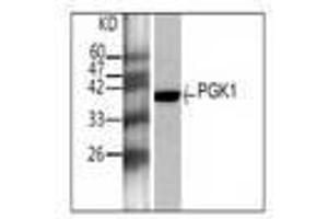Image no. 1 for anti-Phosphoglycerate Kinase 1 (PGK1) antibody (ABIN791507) (PGK1 antibody)