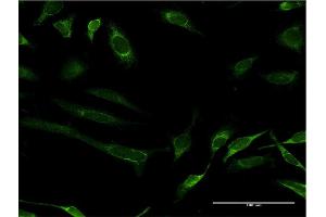 Immunofluorescence of monoclonal antibody to FH on HeLa cell. (FH antibody  (AA 33-510))