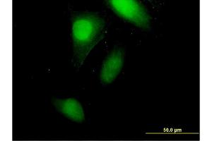 Immunofluorescence of monoclonal antibody to CRABP2 on HeLa cell. (CRABP2 antibody  (AA 1-138))