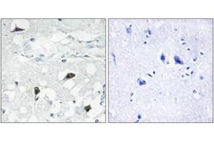 Immunohistochemistry analysis of paraffin-embedded human brain tissue, using Caspase 3 (Cleaved-Asp175) Antibody. (Caspase 3 antibody  (Cleaved-Asp175))