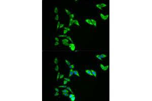 Immunofluorescence analysis of A549 cells using AK1 antibody. (Adenylate Kinase 1 antibody)