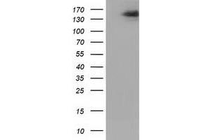 HEK293T cells were transfected with the pCMV6-ENTRY control (Left lane) or pCMV6-ENTRY L1CAM (Right lane) cDNA for 48 hrs and lysed. (L1CAM antibody)