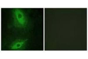 Immunofluorescence analysis of HeLa cells, using TNFSF15 antibody. (TNFSF15 antibody  (C-Term))