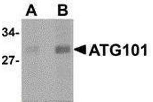 Western Blotting (WB) image for anti-Chromosome 12 Open Reading Frame 44 (C12orf44) (Center) antibody (ABIN2477522) (ATG101 antibody  (Center))