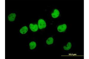 Immunofluorescence of monoclonal antibody to FKBP5 on HeLa cell. (FKBP5 antibody  (AA 1-457))