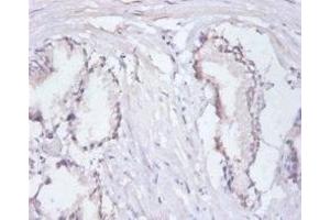 Immunohistochemistry of paraffin-embedded human prostate tissue using ABIN7167685 at dilution of 1:100 (RPA3 antibody  (AA 1-119))