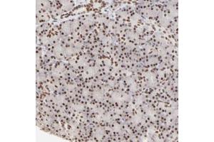Immunohistochemical staining (Formalin-fixed paraffin-embedded sections) of human pancreas with PBX1 polyclonal antibody  shows strong nuclear positivity in exocrine glandular cells. (PBX1 antibody)
