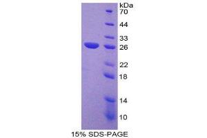 SDS-PAGE (SDS) image for Nucleoporin 133kDa (NUP133) (AA 899-1091) protein (His tag) (ABIN2126138)