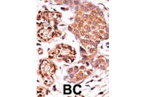 Immunohistochemistry (IHC) image for anti-C-Abl Oncogene 1, Non-Receptor tyrosine Kinase (ABL1) (pTyr412) antibody (ABIN3001744)