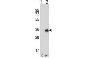 Western blot analysis of CNOT8 (arrow) using rabbit polyclonal CNOT8 Antibody (N-term) . (CNOT8 antibody  (N-Term))