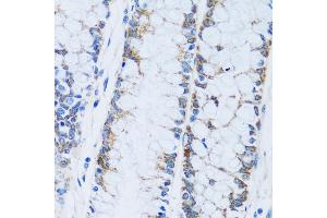 Immunohistochemistry of paraffin-embedded human colon using C antibody (ABIN7266074) at dilution of 1:100 (40x lens).